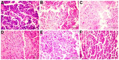 Effects of Sophora flavescens aiton and the absorbed bioactive metabolite matrine individually and in combination with 5-fluorouracil on proliferation and apoptosis of gastric cancer cells in nude mice